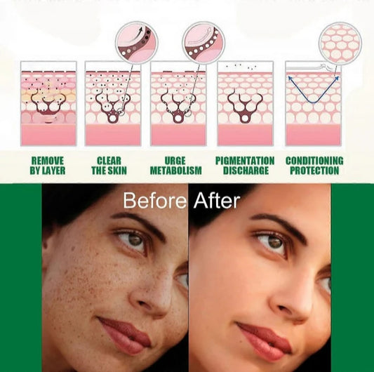 Aura Skin Science Niacinamide 10% Dark Spot Corrector